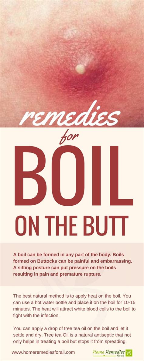 boil on my buttcheek